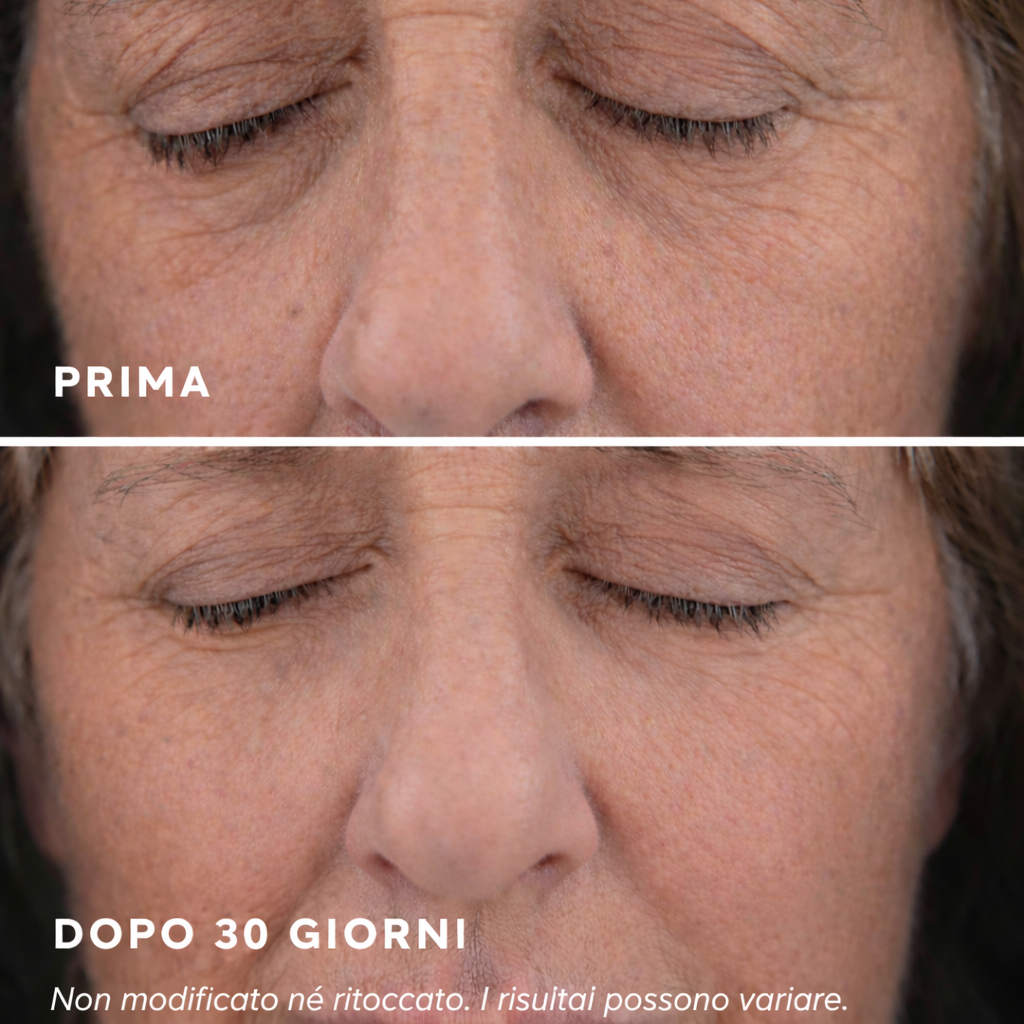 Auroreum 24K Gold Eye Patches